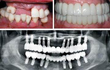 Align Dental Care