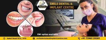 Top-Rated Dental Hospital near Me in AS Rao Nagar, Secunderabad
