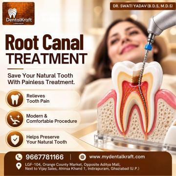 RCT Clinic in Indirapuram for Root Canal Treatment