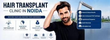 Best Hair Transplant Clinic in Noida for Natural & Permanent Hair Regrowth