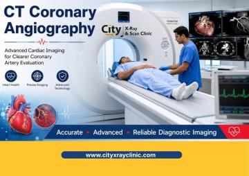 CT Coronary Angiography – Advanced Cardiac Imaging