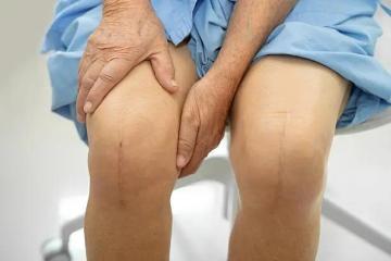 Best Knee Replacement Surgery in Gandhinagar