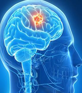 Best Brain Surgeon in Krpuram