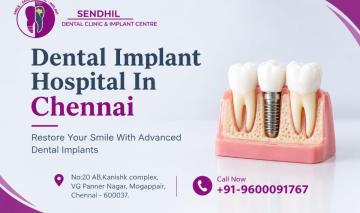 dental implant hospital in chennai | Sendhil Dental