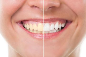 family dentist chino hills