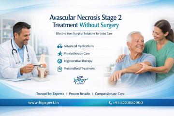 Avascular Necrosis Stage 2 Treatment Without Surgery – HipXpert