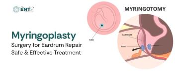 Myringoplasty Surgery for Eardrum Repair – Safe & Effective Treatment