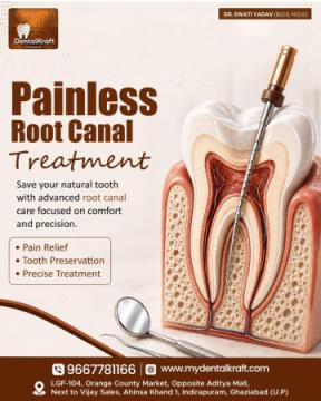 RCT Clinic in Indirapuram for Root Canal Treatment