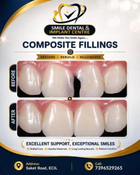 Dental Filling Cost in Sainikpuri, Secunderabad