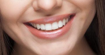 Get a New Smile with Free Dental Implants in Florida