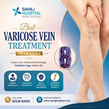Best Varicose Vein Treatment in Indore - Sahaj Hospital