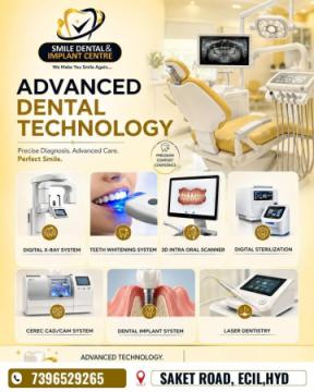 Top Dental Clinic Serving Dammaiguda – Smile Dental & Implant Centre