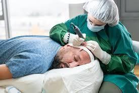 Best Hair Loss Clinic in Bangalore