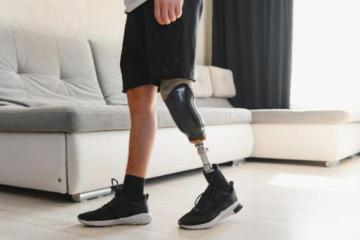 Modern Above Knee Prosthetics for Enhanced Mobility Support