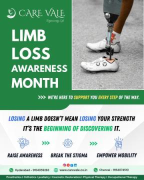 Best Artificial Leg in Hyderabad | CareVale Prosthetics