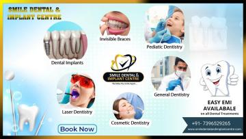 Smile Dental and Implant Centre – 15+ Years of Trusted Dental Care in Secunderabad