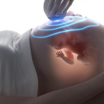 3D Ultrasound Mississauga