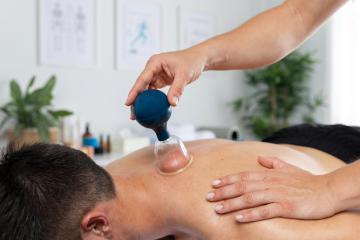 Professional Cupping Therapy Care for Recovery in Fremont CA