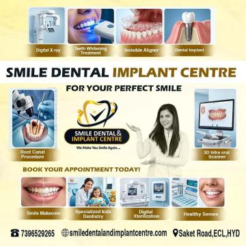 Best Dental Clinic in AS Rao Nagar – Expert Care for Implants, RCTs & Braces