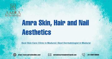 Advanced Dermato Surgery in Madurai for Healthy, Clear Skin