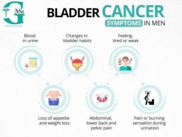 Bladder cancer treatment in yamunanagar with trusted specialist