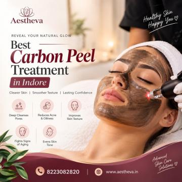 Best Carbon Peel Treatment in Indore - Aestheva