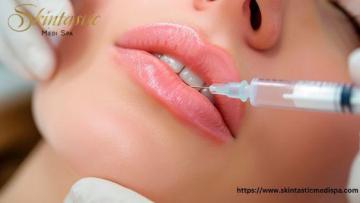 Enhance Your Smile with Best Lip Fillers Riverside