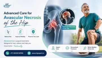 Advanced Non Surgical Treatments for Avascular Necrosis - HipXpert