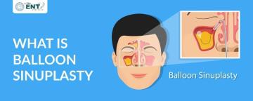 What Is Balloon Sinuplasty? Safe & Effective Sinus Treatment