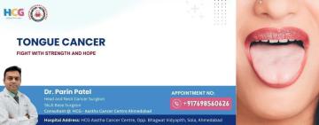 Experienced Tongue Cancer Surgeon in Ahmedabad