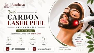 Best Carbon Laser Peel Treatment in Indore – Aestheva