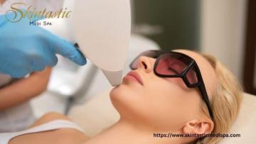 Flawless Skin with Laser Hair Removal in Riverside