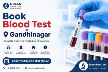 Book Blood Test in Gandhinagar - Nidan Path Lab