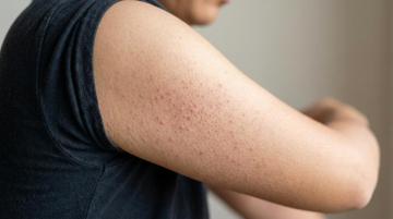 TryStrawberry: Skin Care for Texture, Tone & Clarity