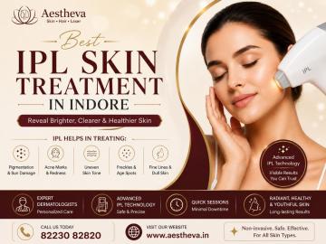 Best IPL Skin Treatment In Indore