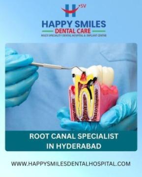 Painless Root Canal Specialist in Hyderabad | Expert Dental Care
