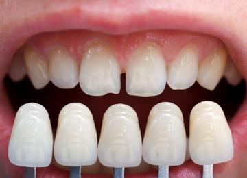 Best Dental Clinic in Vasna