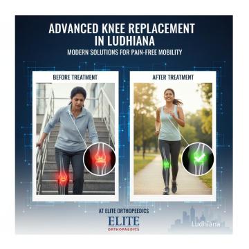 Advanced Knee Replacement Care in Ludhiana – Your Complete Guide to Pain-Free Mobility