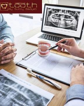 Get Natural, Lasting Results with Full Mouth Dental Implants!- Book Now