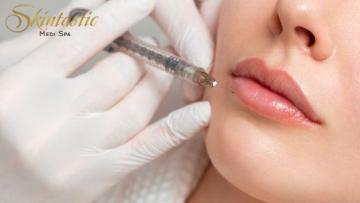 Best Lip Fillers Riverside for Natural Looking Lips