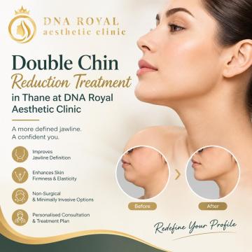 Double Chin Reduction Treatment in Thane at DNA Royal Aesthetic Clinic