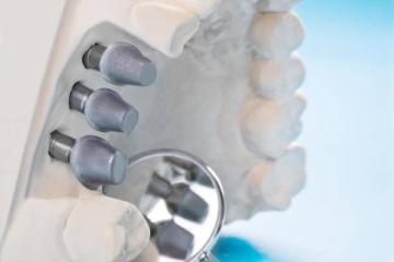 Raman Nazari, The Best Dental Doctor in San Jose