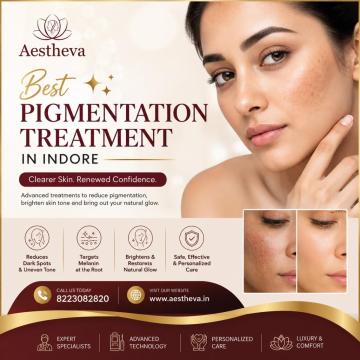 Pigmentation Treatment in Indore - Aestheva