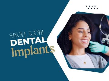 Grab offers and deals on tooth implants solution