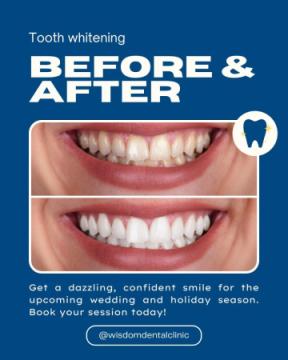 Dental clinic Sector 23 in Gurugram