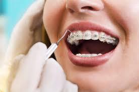 Best dental clinic in Thanisandra