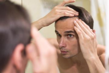 FUE Hair Transplant in Islamabad – Natural Hair Restoration