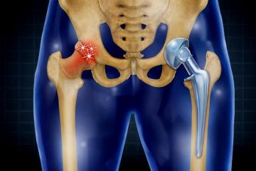 Top Orthopedic Doctor Near Me, Kothagudem