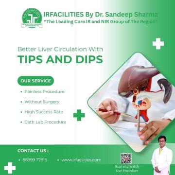 Procedure for TIPS - Managing Advanced Liver Diseases | IRFacilities