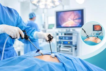 Learning About Keyhole Surgery and Recovery